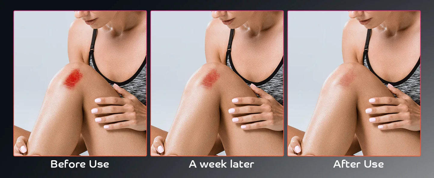 Portable Red Light Therapy Torch – 660nm & 850nm Handheld Pain Relief Wand
